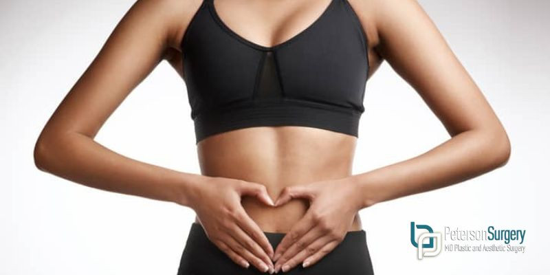 A Guide To Exercising After A Tummy Tuck
